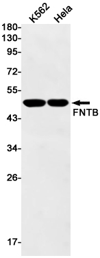 FNTB