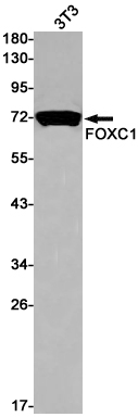 FOXC1