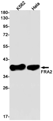 FRA2