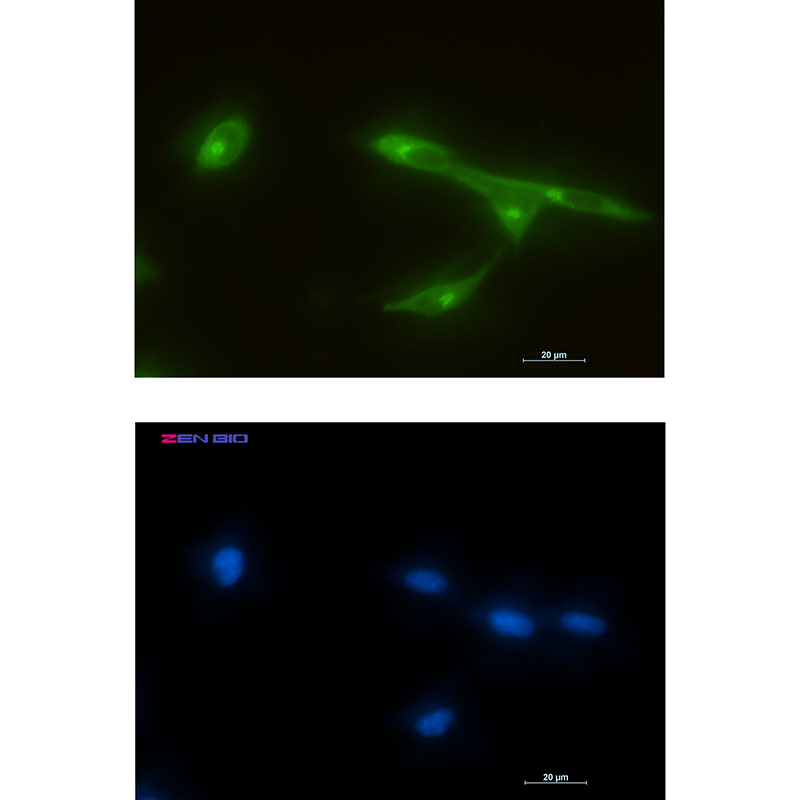 Rabbit Monoclonal Antibody to FRAT1