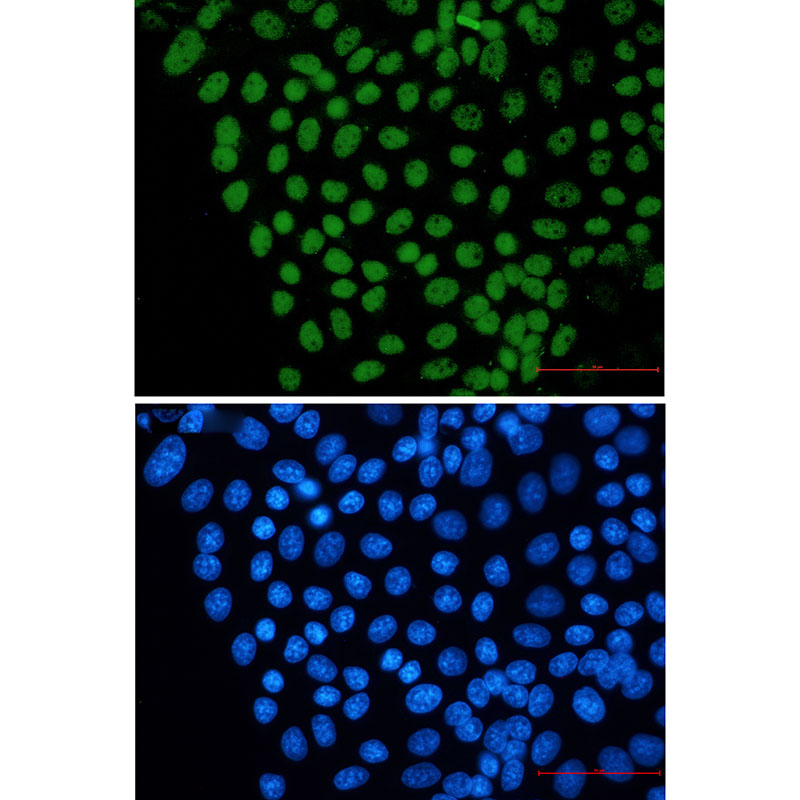 Rabbit Monoclonal Antibody to FTO