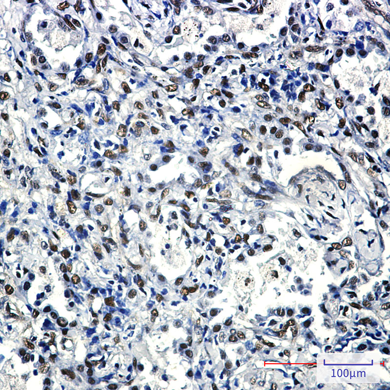 Rabbit Monoclonal Antibody to FTO