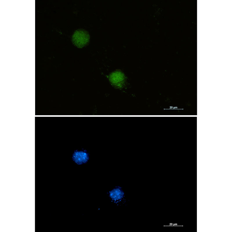 Rabbit Monoclonal Antibody to FUBP1