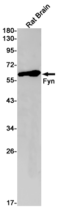 Rabbit Monoclonal Antibody to FYN