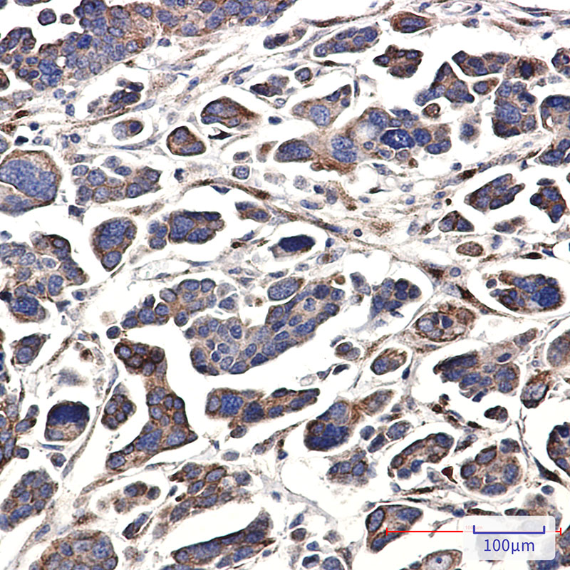 Rabbit Monoclonal Antibody to GNA13