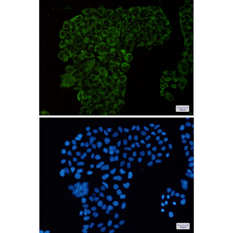 Rabbit Monoclonal Antibody to G3BP
