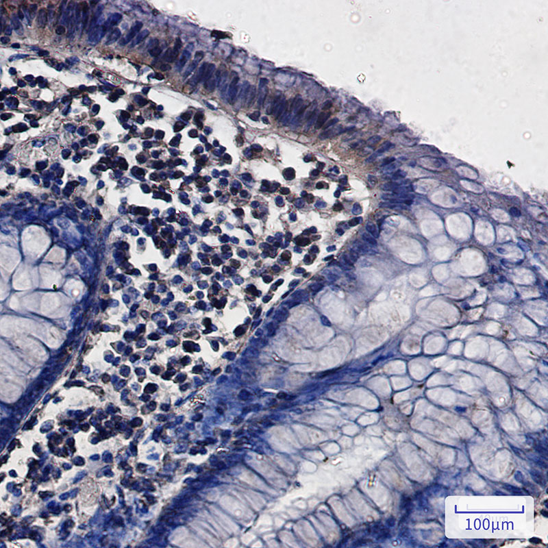Rabbit Monoclonal Antibody to G3BP