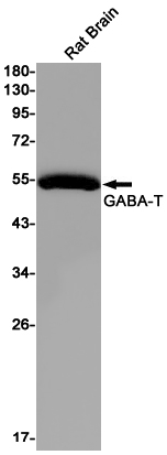 Rabbit Monoclonal Antibody to ABAT
