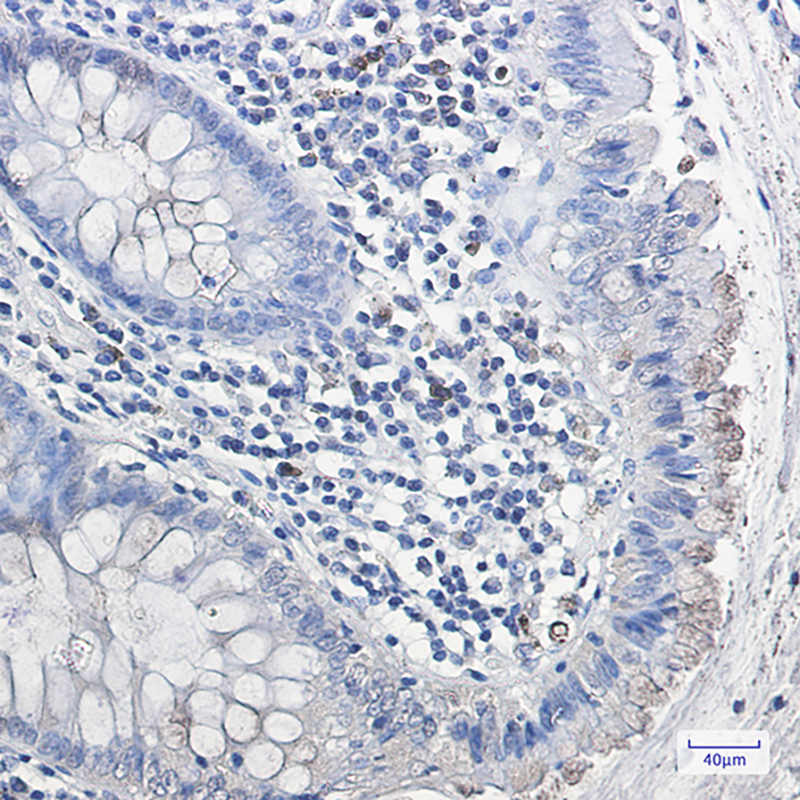 Rabbit Monoclonal Antibody to Galactosidase alpha