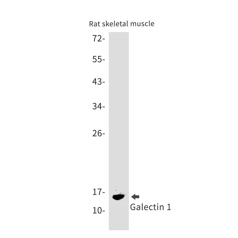 Galectin 1