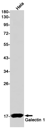 Rabbit Monoclonal Antibody to Galectin 1