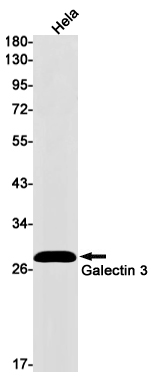 Galectin 3