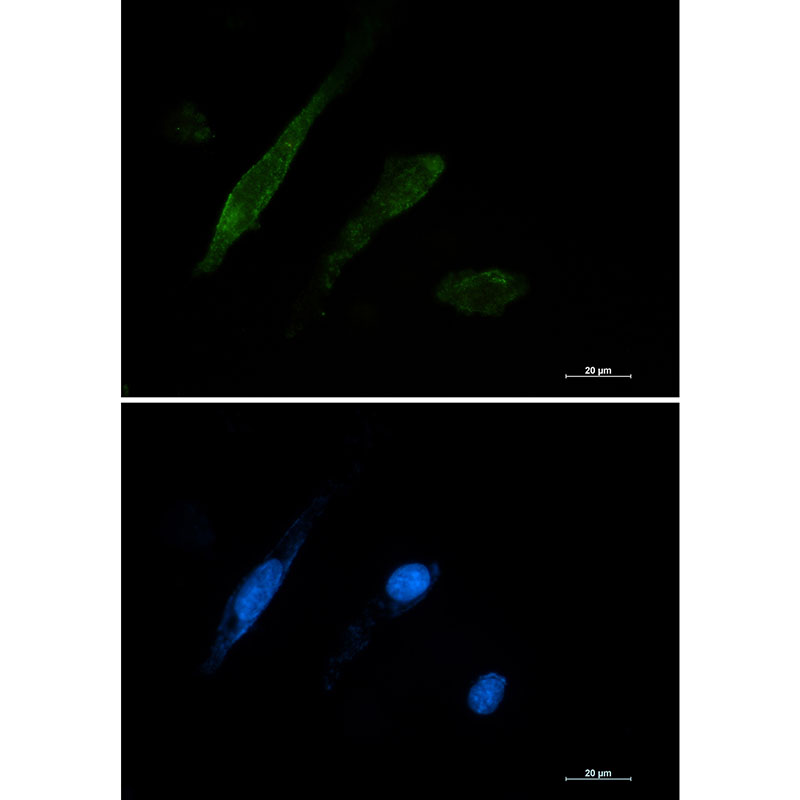 Rabbit Monoclonal Antibody to Galectin 3