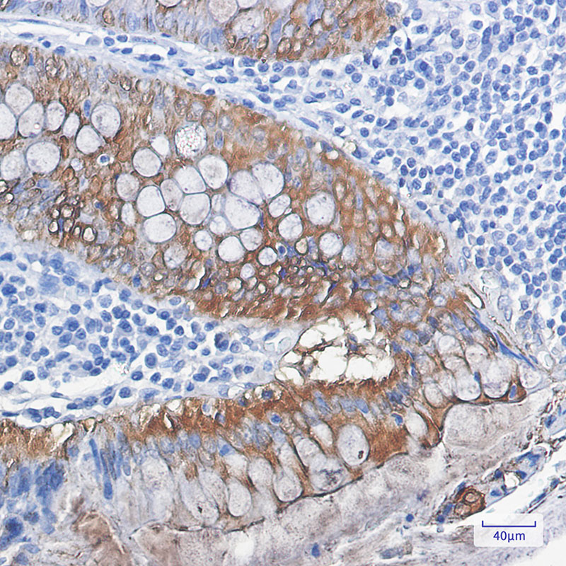 Rabbit Monoclonal Antibody to Galectin 3