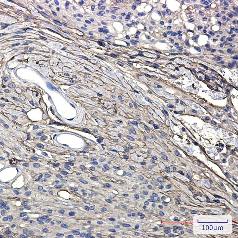 Rabbit Monoclonal Antibody to GAP43