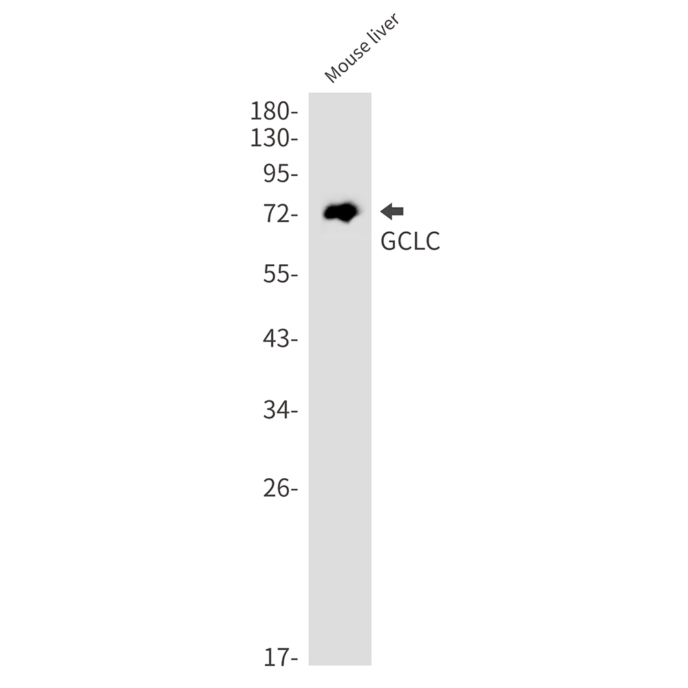 GCLC