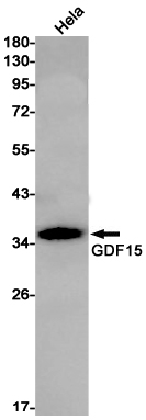GDF15
