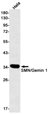SMN