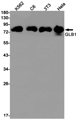 GLB1