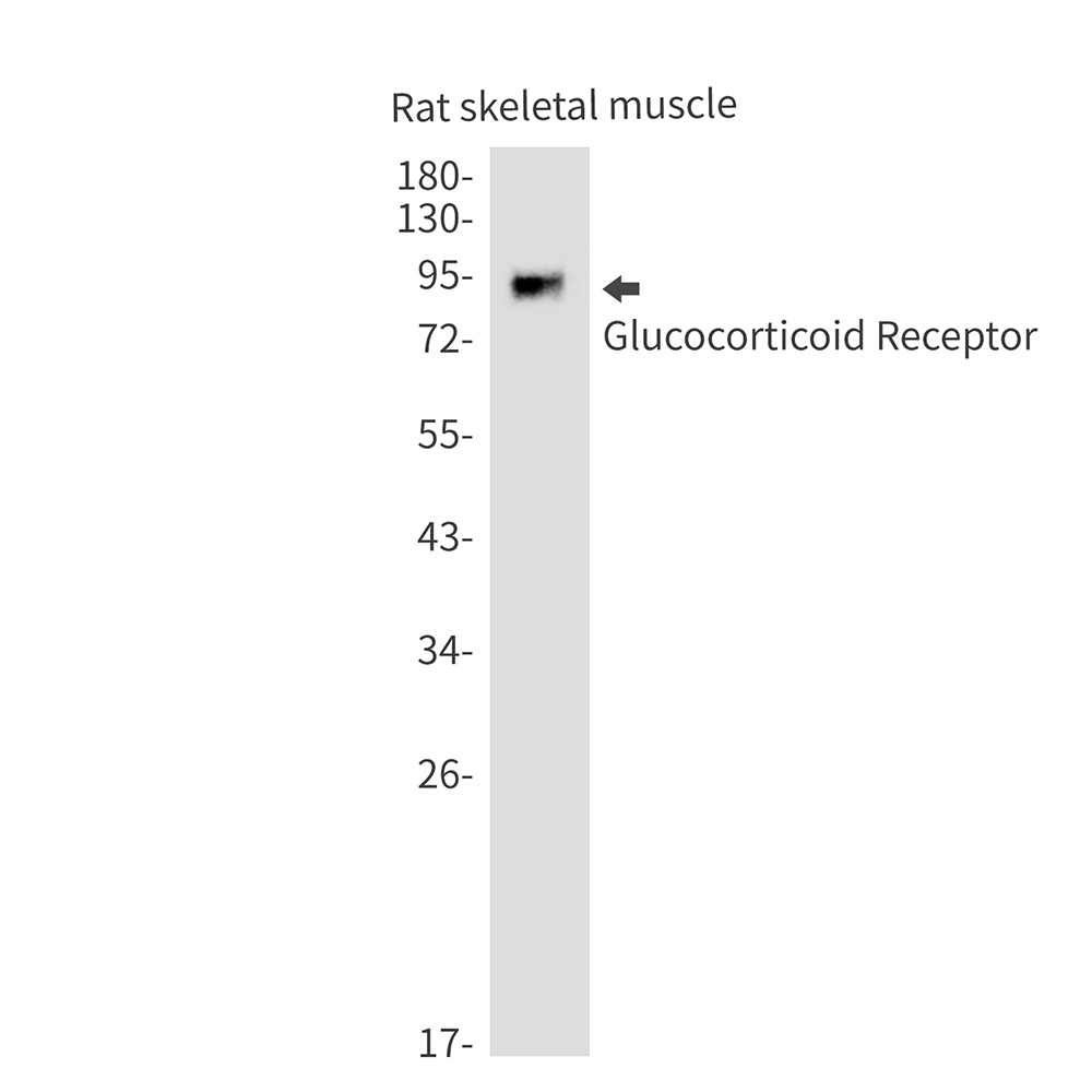 Glucocorticoid Receptor