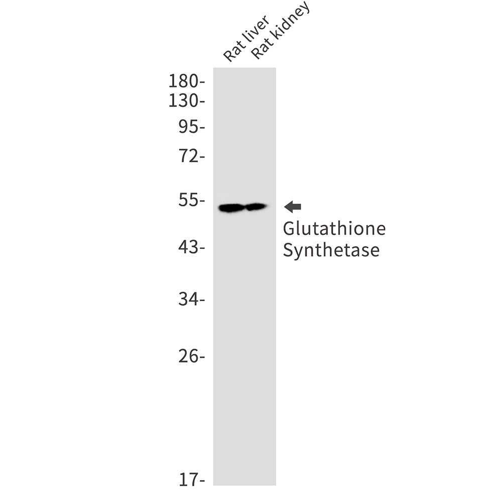 Glutathione Synthetase