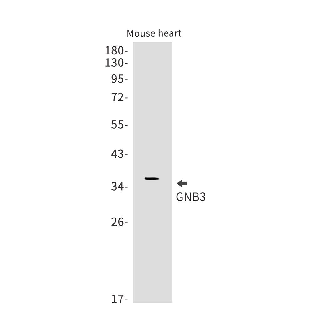 GNB3