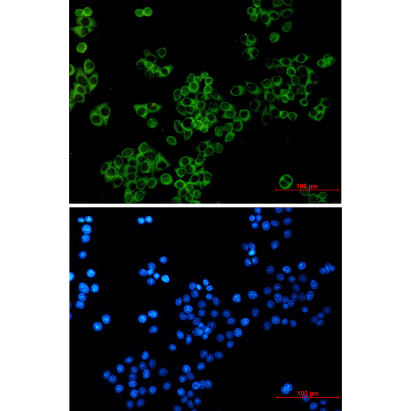 Rabbit Monoclonal Antibody to LGR6