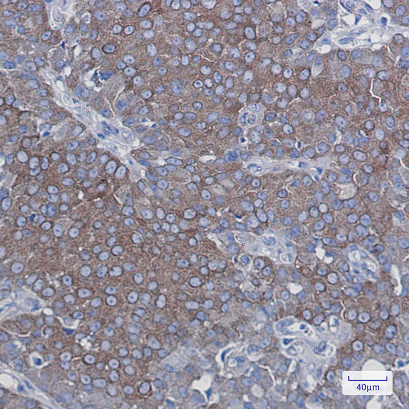 Rabbit Monoclonal Antibody to LGR6
