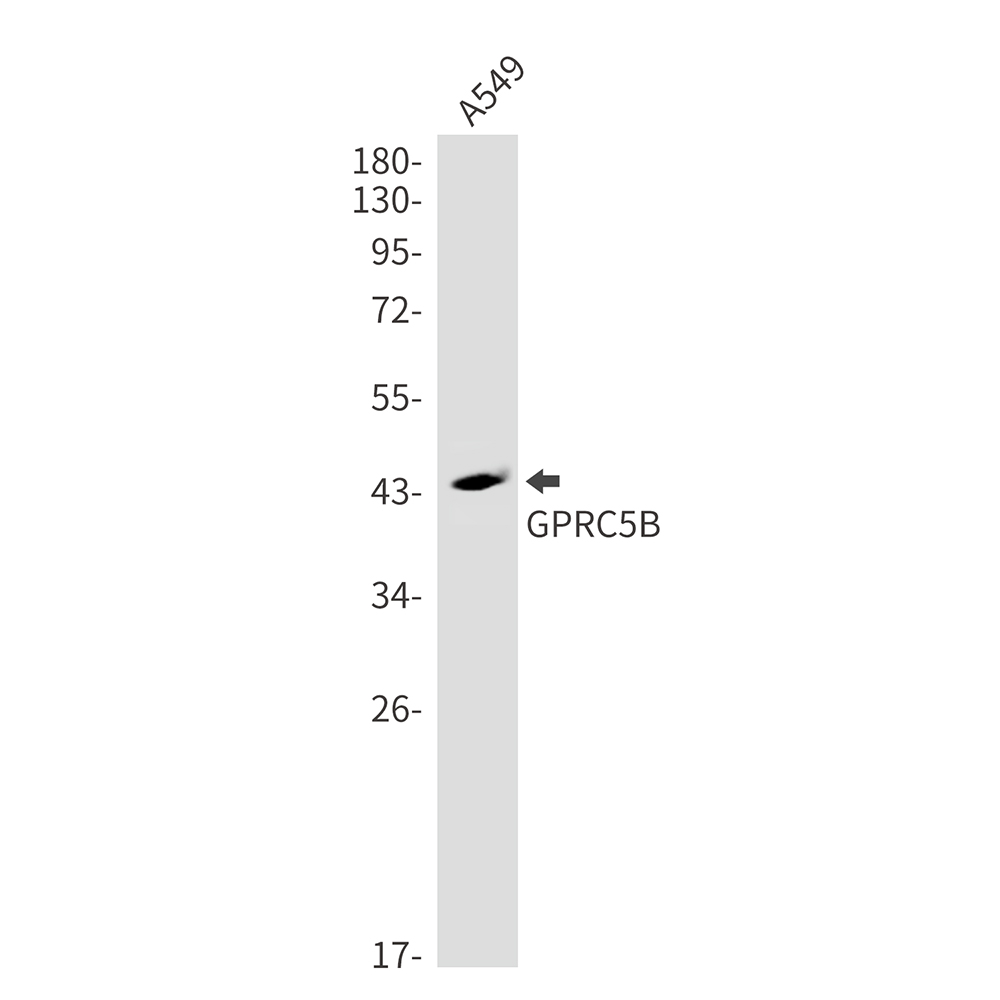 GPRC5B