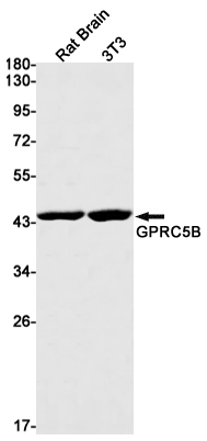Rabbit Monoclonal Antibody to GPRC5B