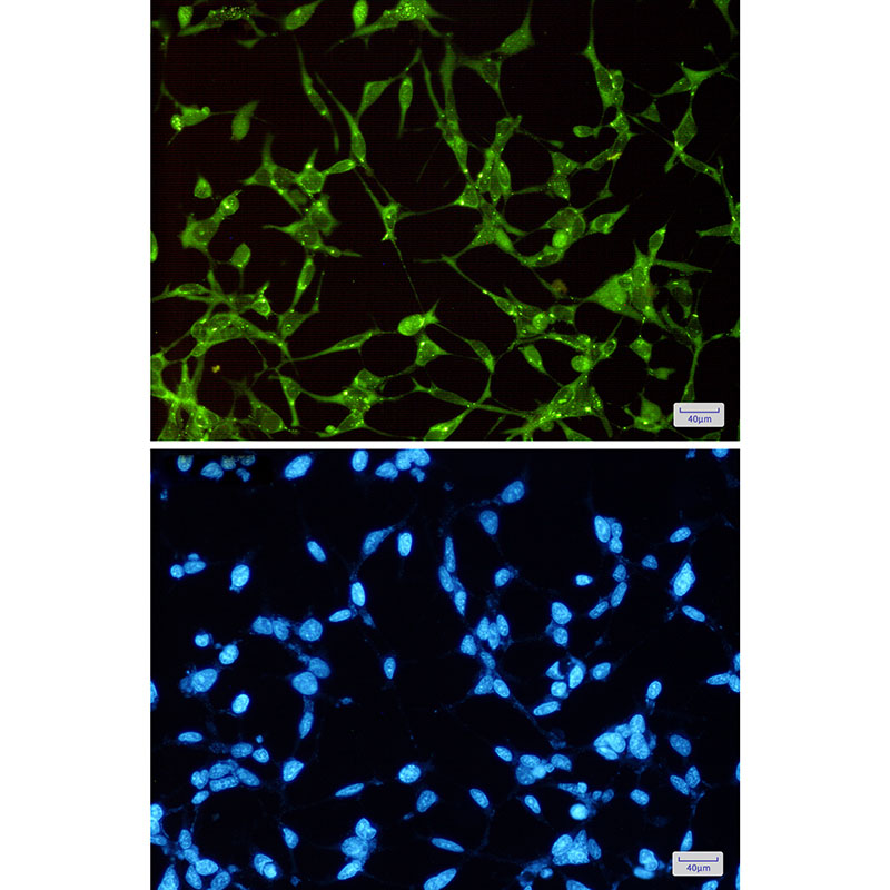 Rabbit Monoclonal Antibody to GSK3 alpha