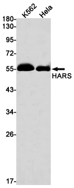 HARS