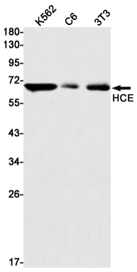 HCE