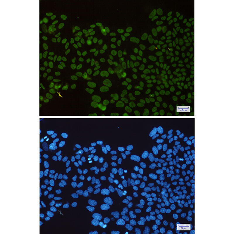 Rabbit Monoclonal Antibody to HDAC2