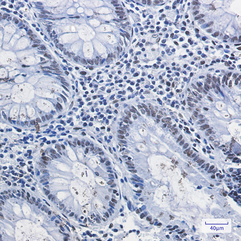 Rabbit Monoclonal Antibody to HDAC2