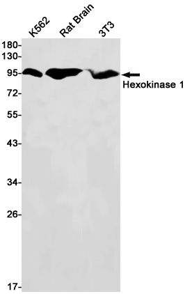 Hexokinase I