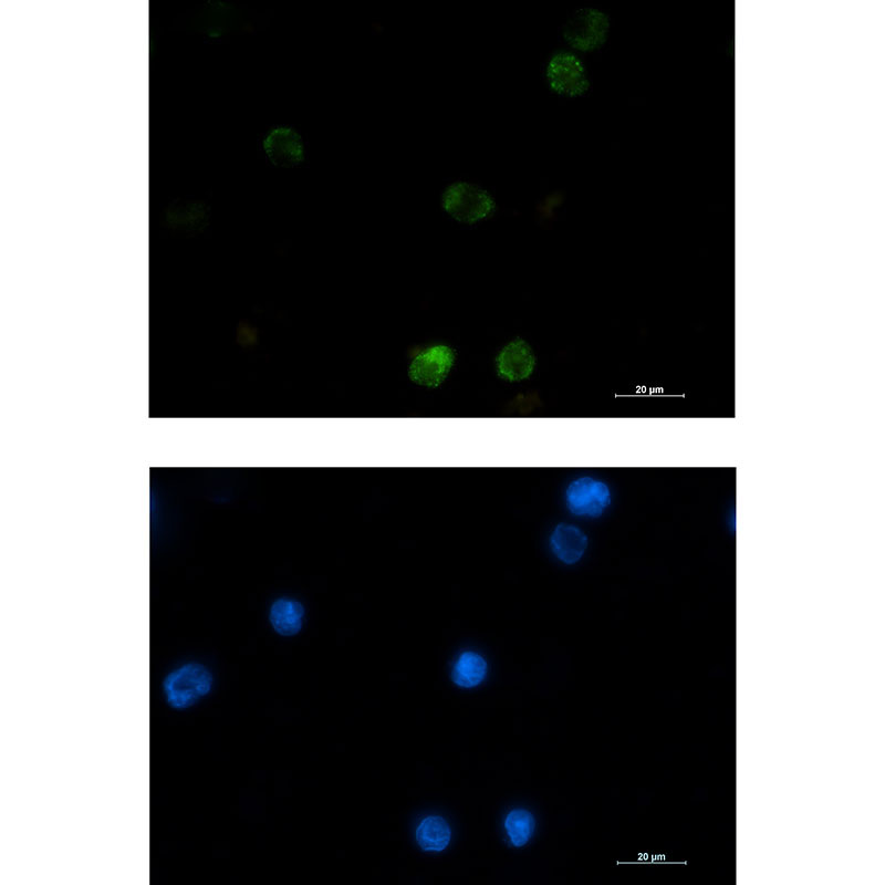 Rabbit Monoclonal Antibody to Hexokinase I