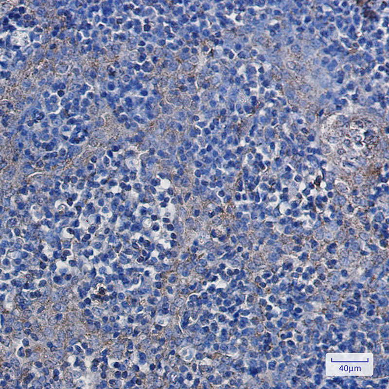 Rabbit Monoclonal Antibody to Hexokinase I