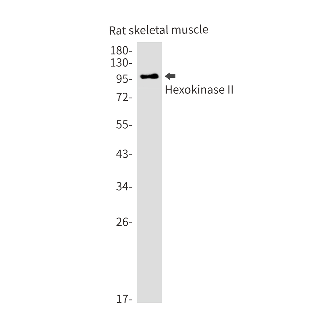 Hexokinase II