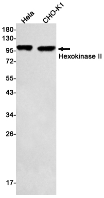 Rabbit Monoclonal Antibody to Hexokinase II