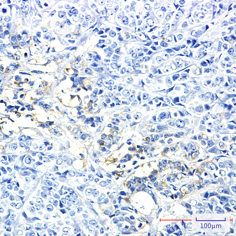 Rabbit Monoclonal Antibody to Hexokinase II