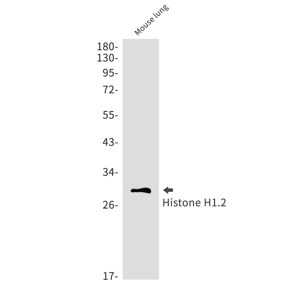 Histone H1.2