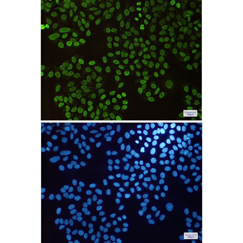 Rabbit Monoclonal Antibody to Histone H1.3