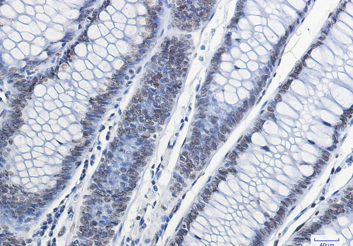 Rabbit Monoclonal Antibody to Histone H2A.X