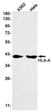 HLA A