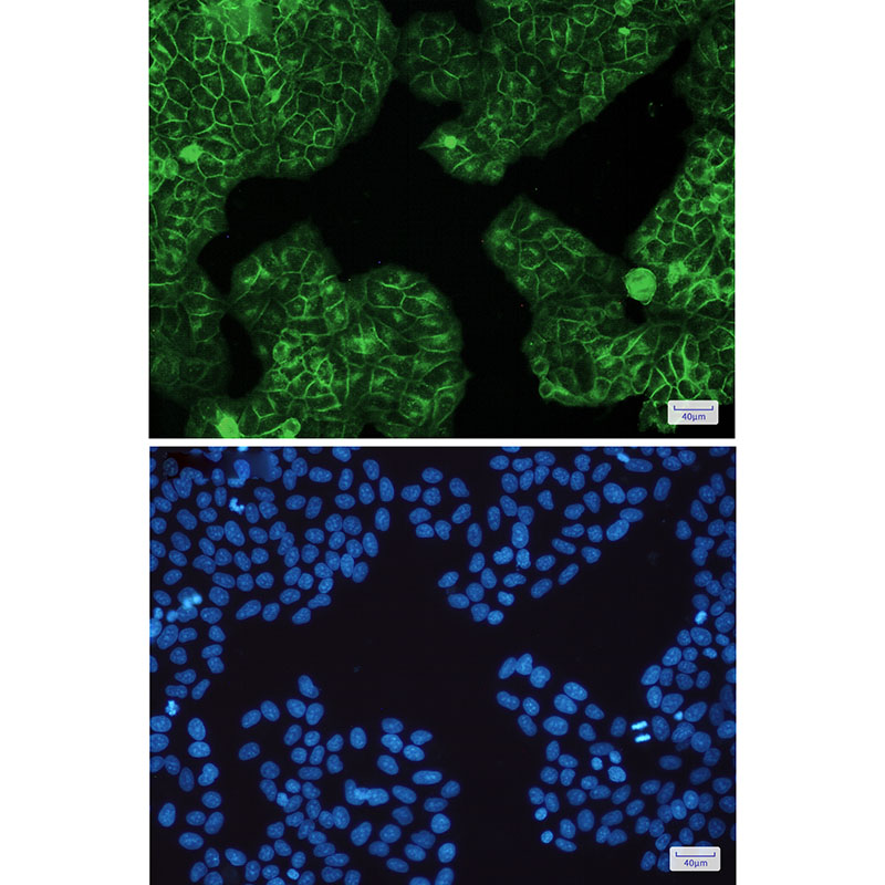 Rabbit Monoclonal Antibody to HLA A