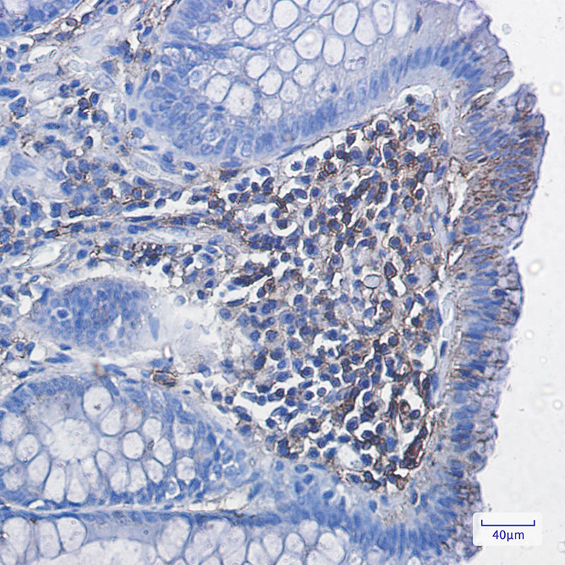 Rabbit Monoclonal Antibody to HLA A