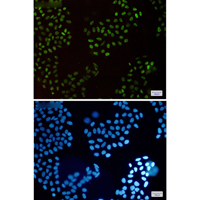Rabbit Monoclonal Antibody to HLTF