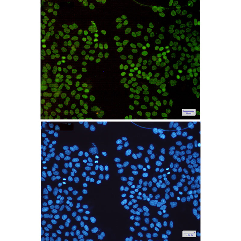 Rabbit Monoclonal Antibody to HMGA1