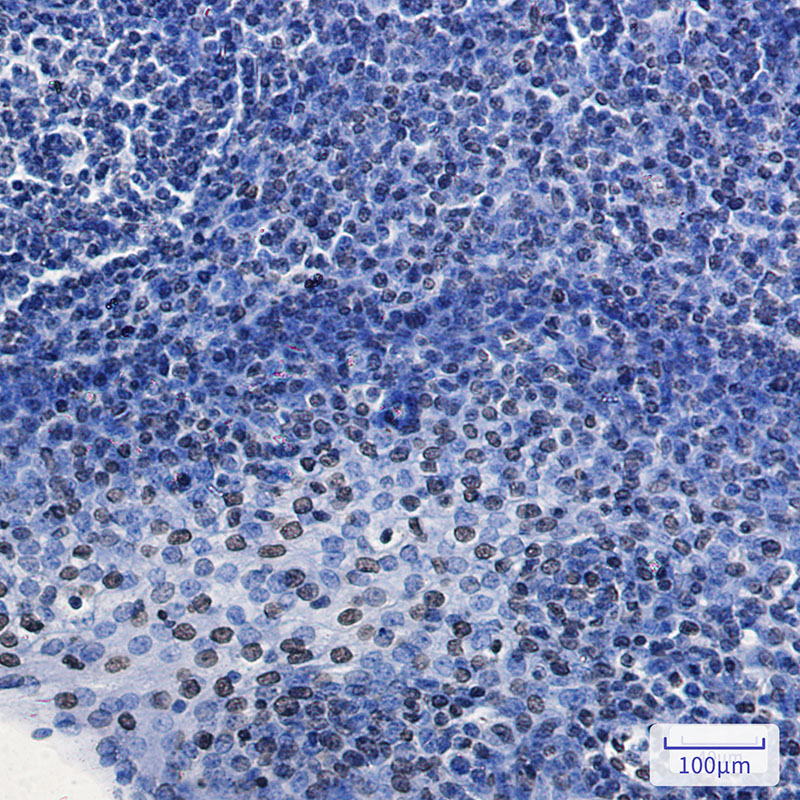 Rabbit Monoclonal Antibody to HMGA1